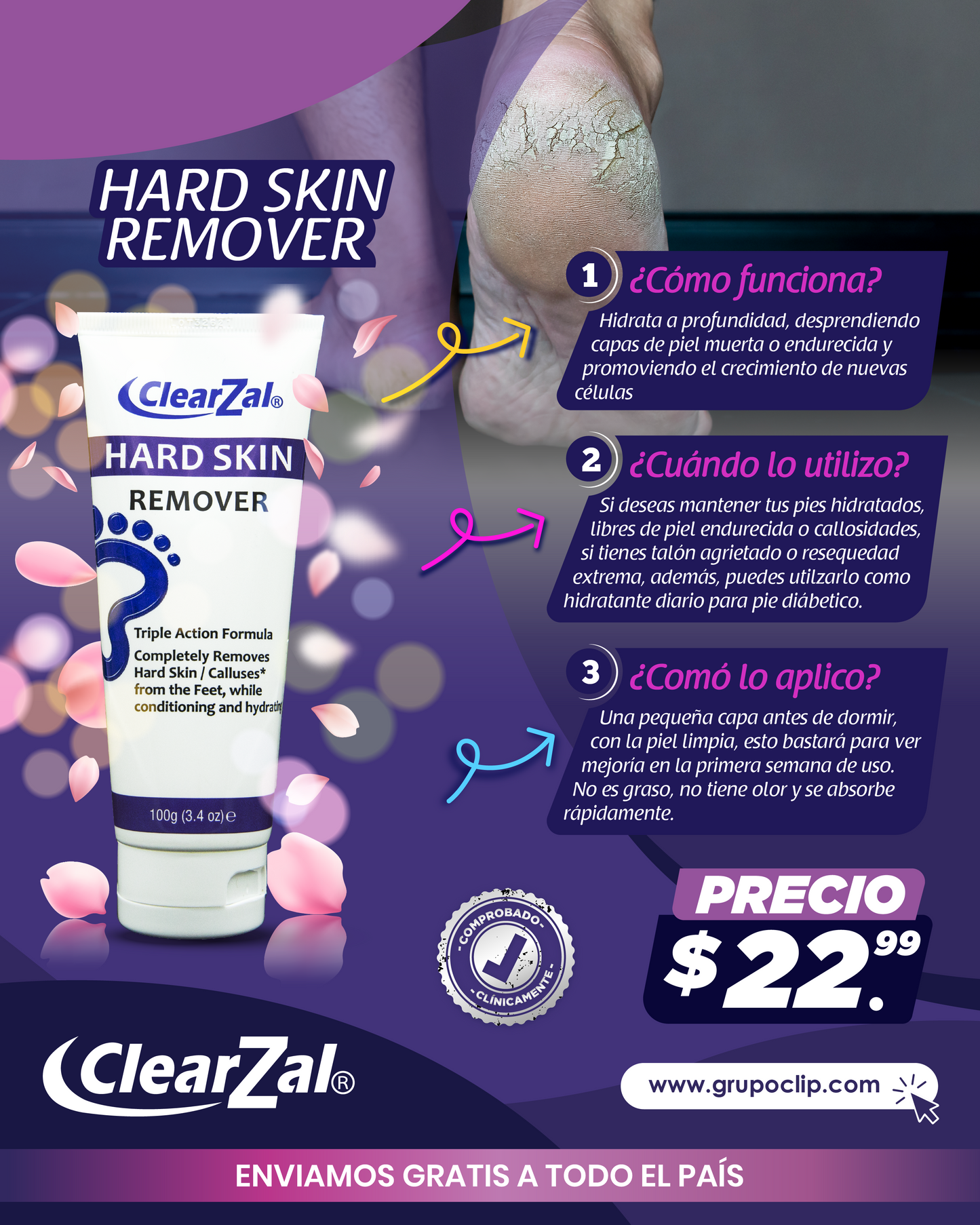 Hard Skin (Removedor de Callos/Hidratante)